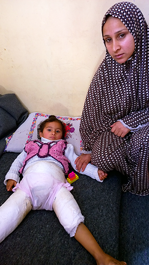 Manal Zanin and her daughter in splints